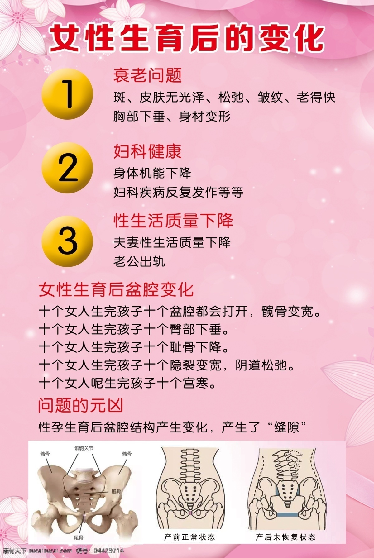 女性 生育 后 變化 生育后的變化 催乳 通乳 生育后女性 生育后婦女 盆骨修復(fù) 生育后骨盆 骨盆變形 盆骨移位 盆底肌松弛 腹壁松弛 臂底下垂 養(yǎng)生調(diào)理 養(yǎng)生 調(diào)理 骨盆修復(fù) 產(chǎn)后調(diào)理 海報 關(guān)愛女性 psd分層 分層