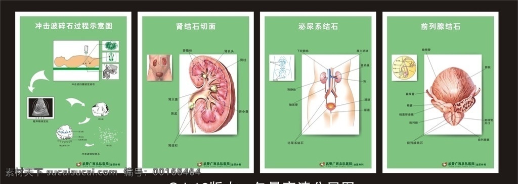 医院结石海报 医院结石广告 医院碎石招贴 医院碎石海报 碎石设计 学生公益广告 招贴设计