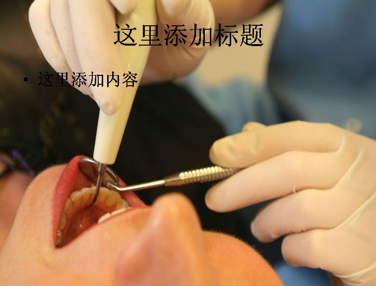 拔牙 牙科医院 科技 模板