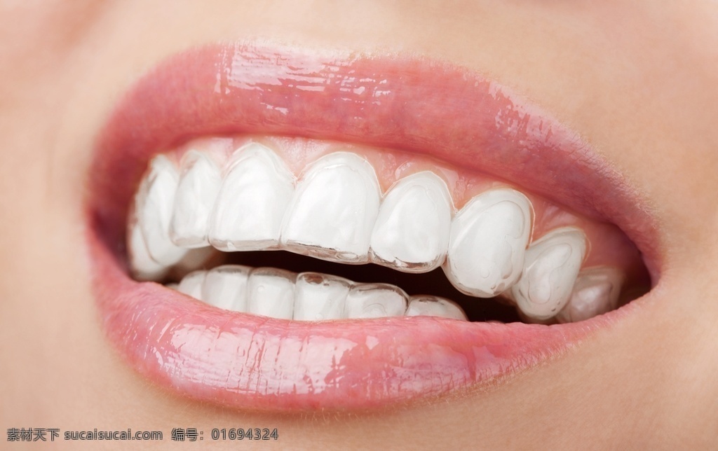 牙箍 牙套 牙线 洁白牙齿 牙齿矫正 口腔护理 牙科 生活百科