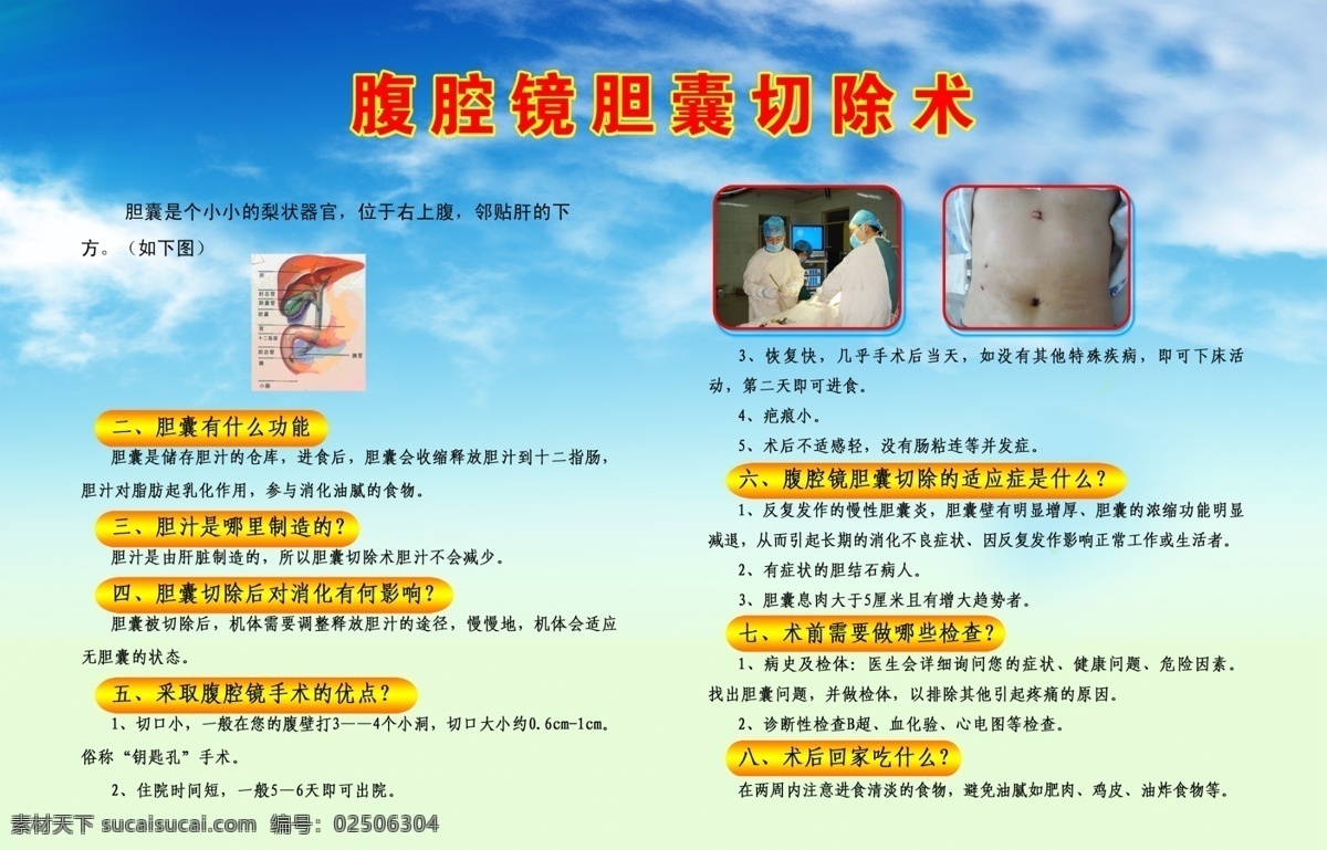腹腔镜 胆囊 切除术 腹腔 镜胆囊切 除术 什么 功能 胆汁 腹腔镜手术 医院展板 背景 分层 源文件库 广告设计模板 展板模板