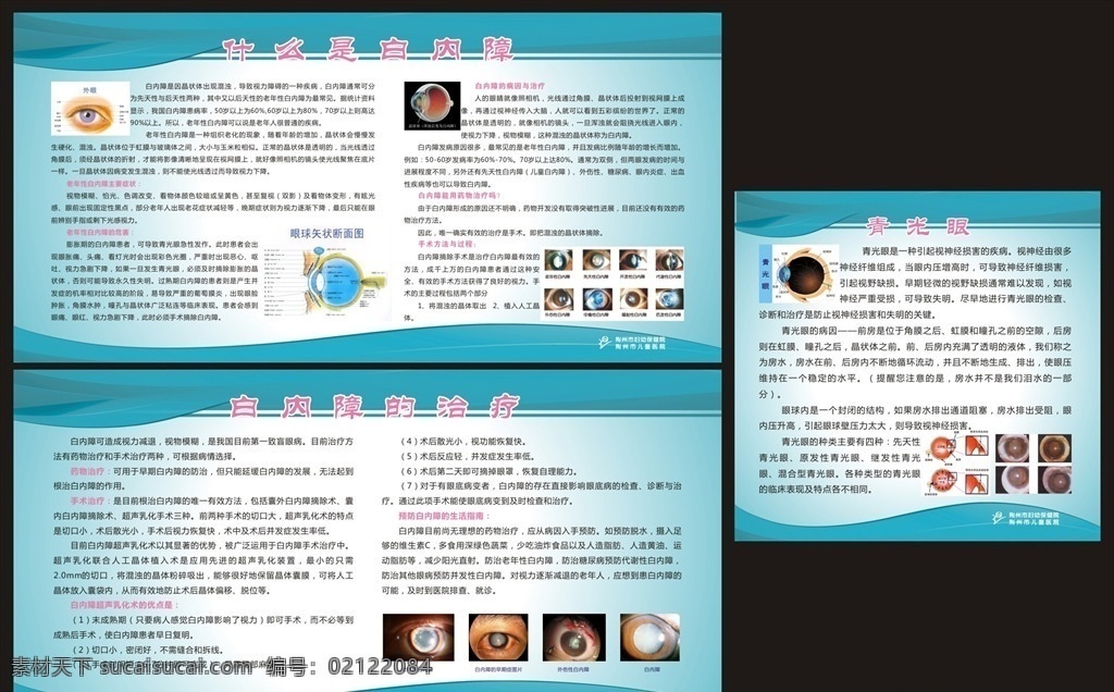 白内障青光眼 白内障 白内障海报 白内障展板 青光眼 青光眼海报 青光眼展板 眼科海报 眼科展板 蓝色海报 蓝色展板 展板设计