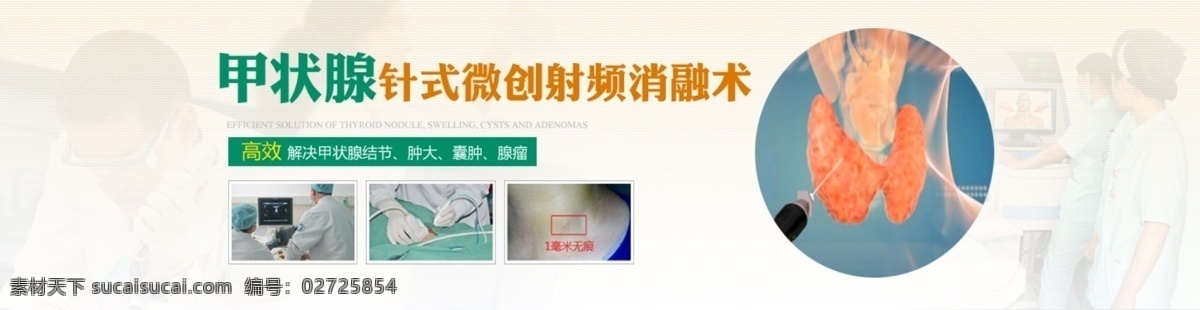 甲状腺 针式 微创 术 医疗 技术 banner 射频 消融术 原创设计 原创网页设计