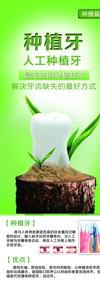 种植牙 牙科宣传 x展架 口腔广告 牙科广告 牙科海报 分层 源文件