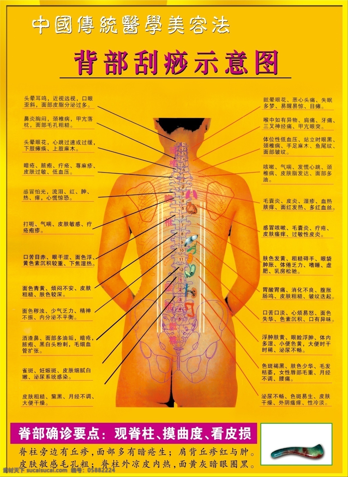 背部 刮痧 中国 传统 医学美容 法 刮痧示意图 人体示意图 脊柱 海报 其他海报设计