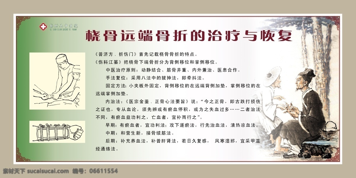 分层 骨科 图版 宣传板 医院 源文件 中医 中医文化 桡骨 远 端 骨折 模板下载 桡骨远端骨折 海报 其他海报设计