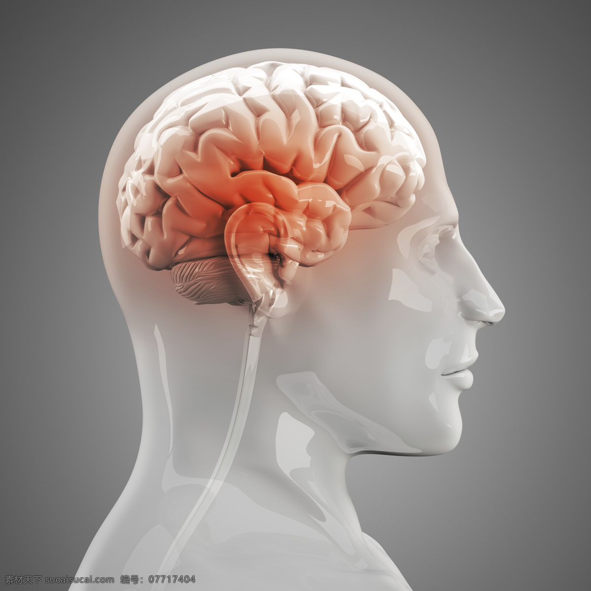 人体 左 脑 x 光 透视图 x光 图像 医疗主题 左脑 大脑 医疗护理 现代科技