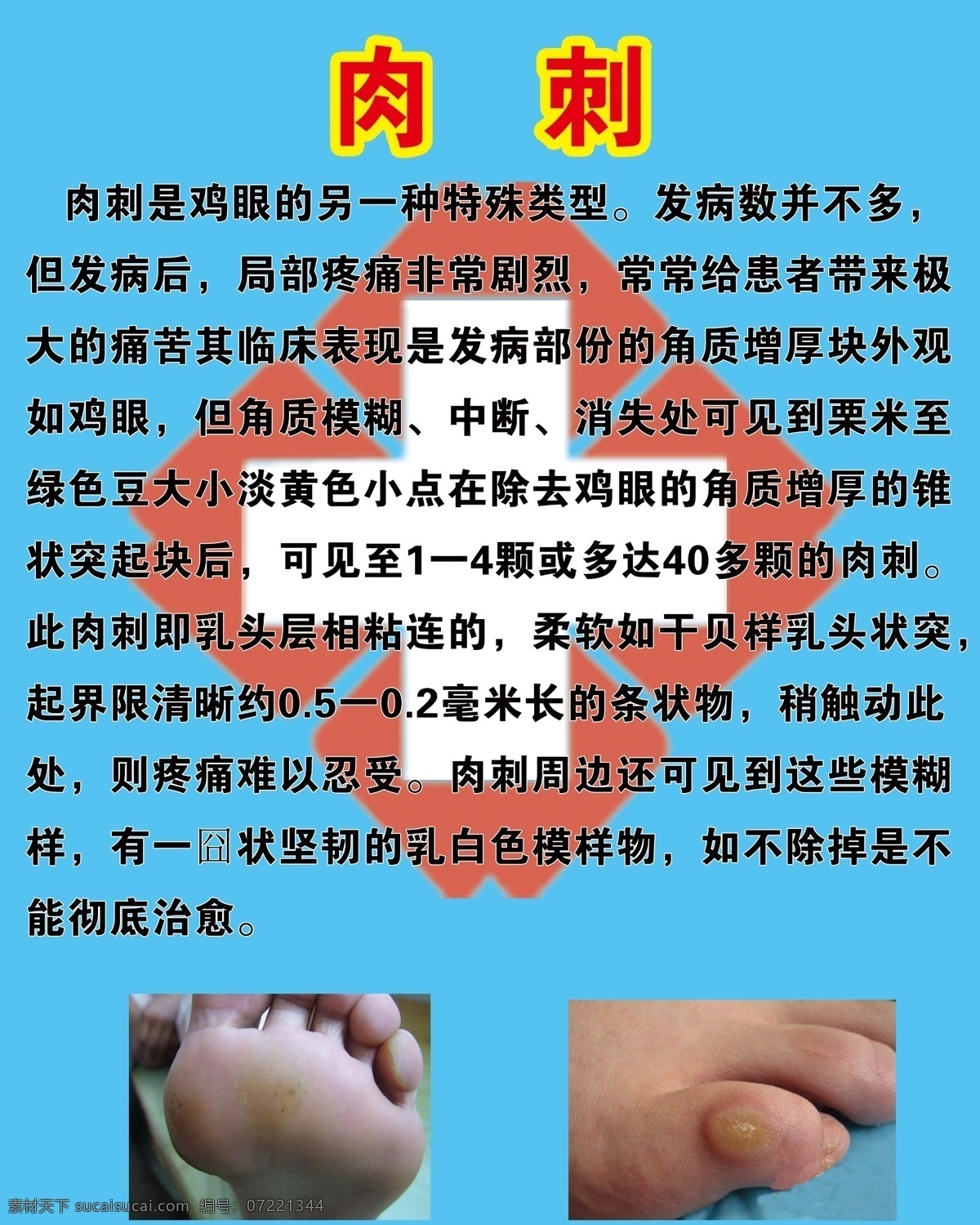 肉刺 症状 样板 疗法 功效 包装设计