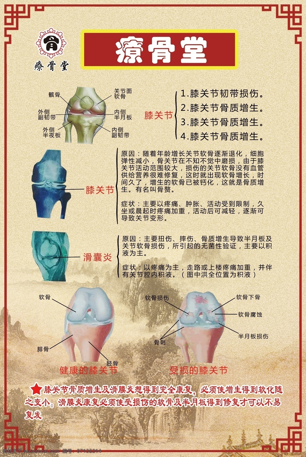 療骨堂 logo 骨骼 膝关节 滑囊炎 平面图 分层