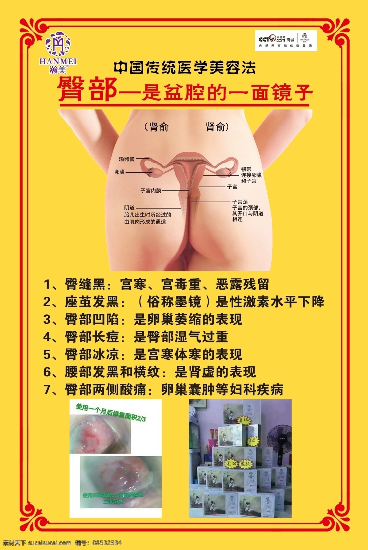 臀部养生图 推拿 按摩 保健 臀部示意图 展板 文化艺术