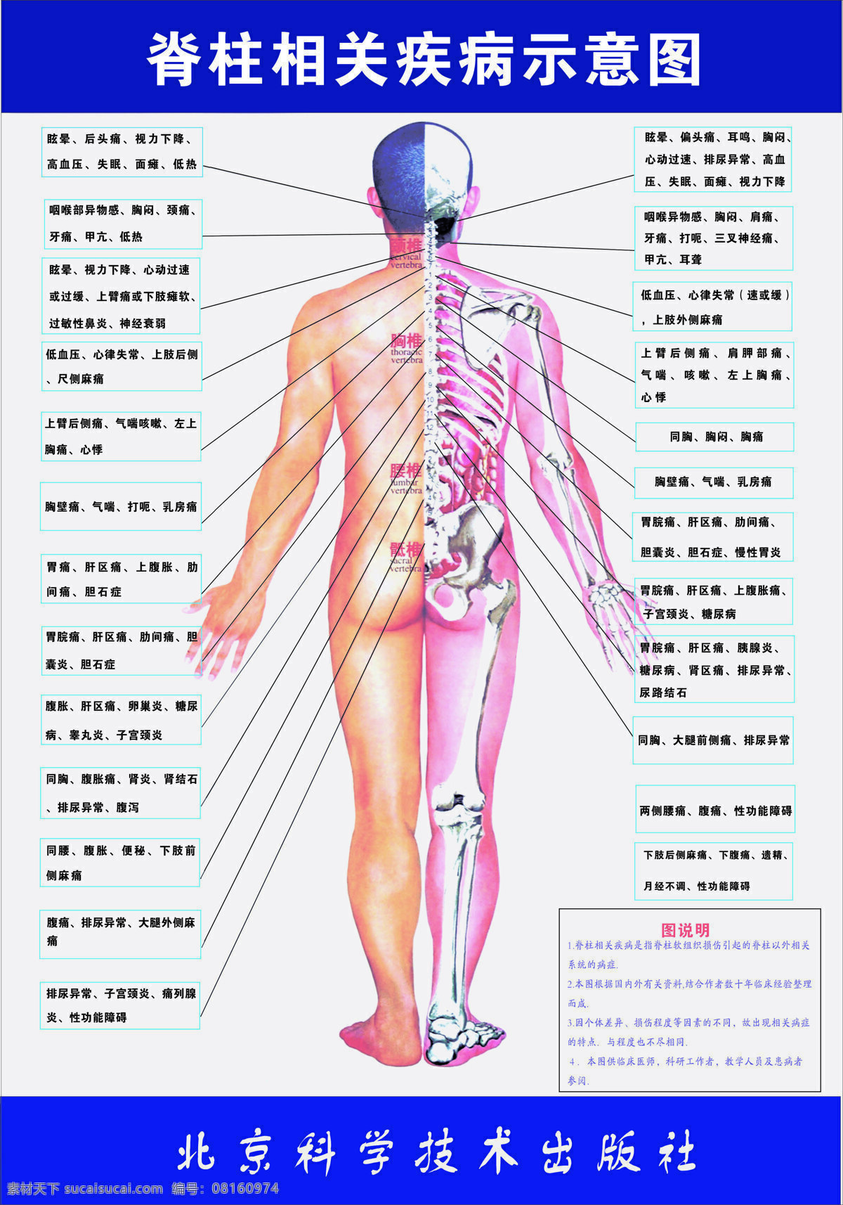 脊柱 相关 疾病 示意图 相关疾病 现代科技 医疗护理 设计图库 女性 人物 300