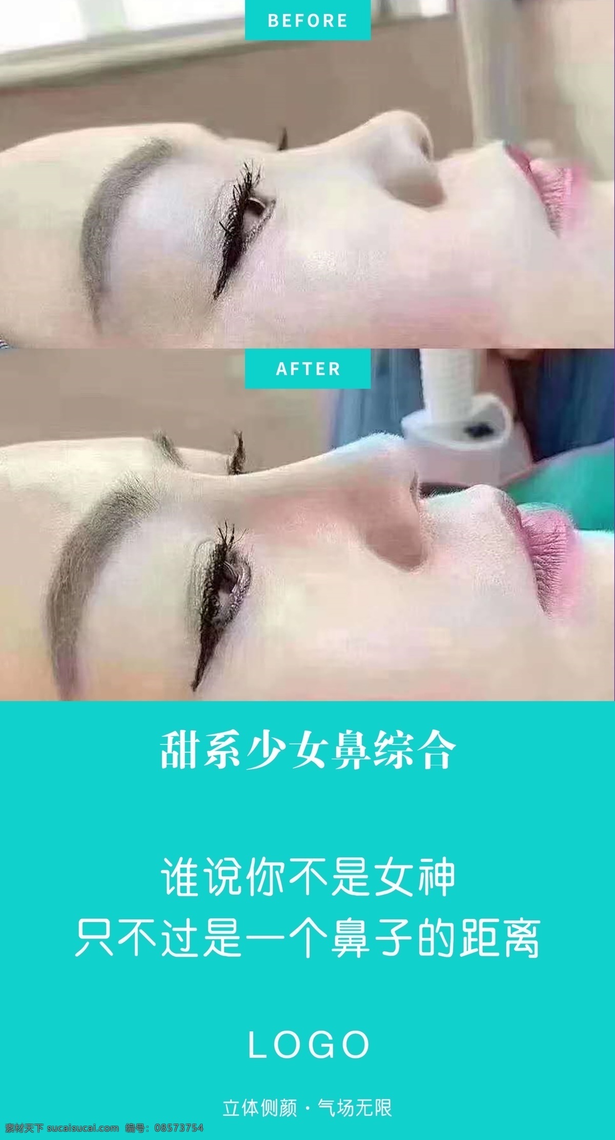 绿色 医 美 对比 图 整形美容专题 活动专题 面部填充 整形美容 整形广告 美容 整形app 整形活动 整形电商 新氧广告 新氧整形 新氧美女 医美对比图 医美海报 美容海报 对比图 医美案例对比 医美 案例对比 整形 整容 整形对比 对比照 案例 术前 术后 手术 医疗美容 简洁 小清新 浅色