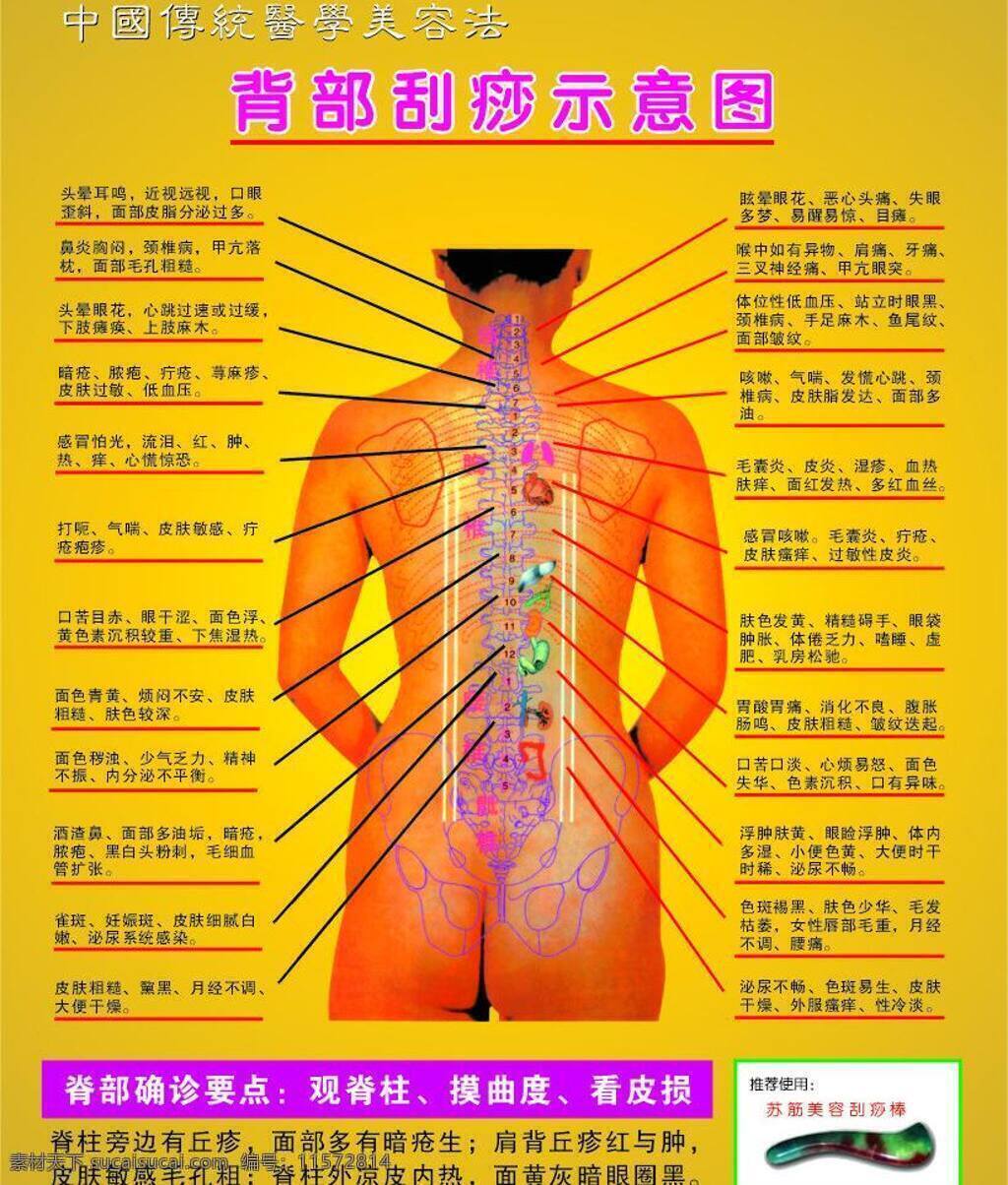 背部 刮痧 示意图 美容 生活百科 医疗保健 刮痧示意图 中国 传统 医学美容 法 对应症状 背部确诊要点 苏 筋 棒 矢量 海报 其他海报设计