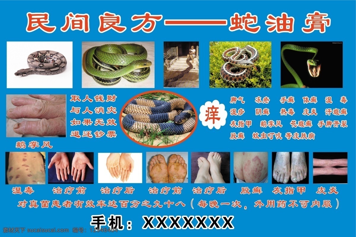 蛇油膏 足癣 股癣 源文件 分层