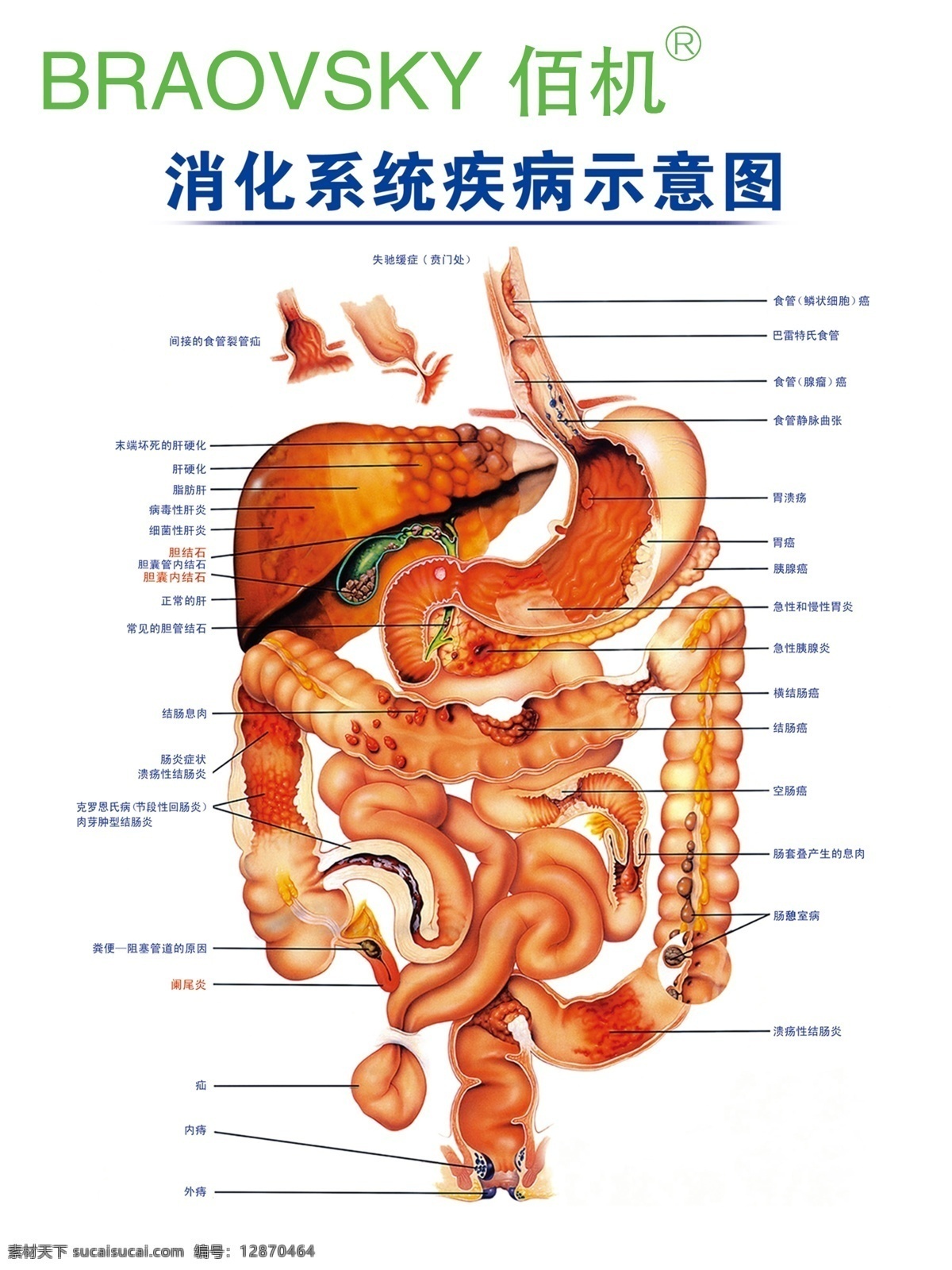 肠道 蠕动 大肠 小肠 演示 人体 医疗 医学 器官 消化 消化系统 排便 排毒 疗效