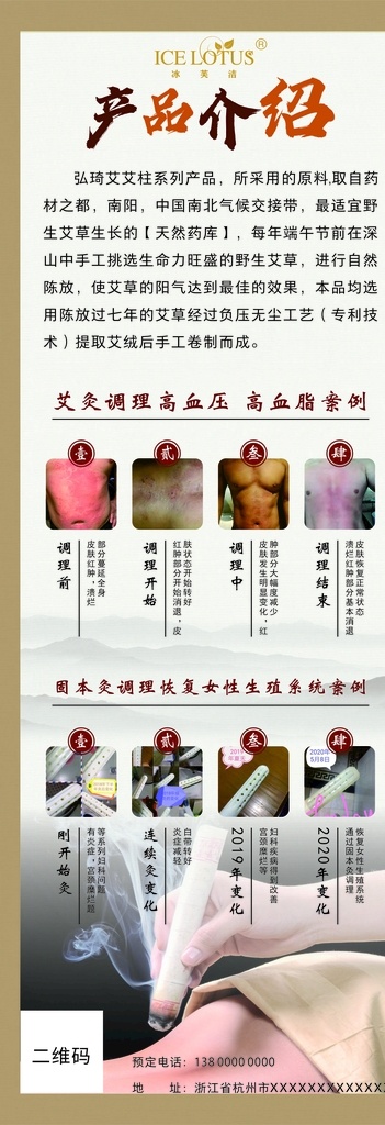 艾灸展架图片 艾灸疗法 艾灸文化 艾灸简介 艾灸功效作用 艾灸海报 艾灸治疗 艾灸展板 艾灸广告 艾灸宣传 艾灸宣传广告 艾灸 针灸 艾灸经络 艾灸香熏 艾灸养生 艾灸挂画 中医艾灸