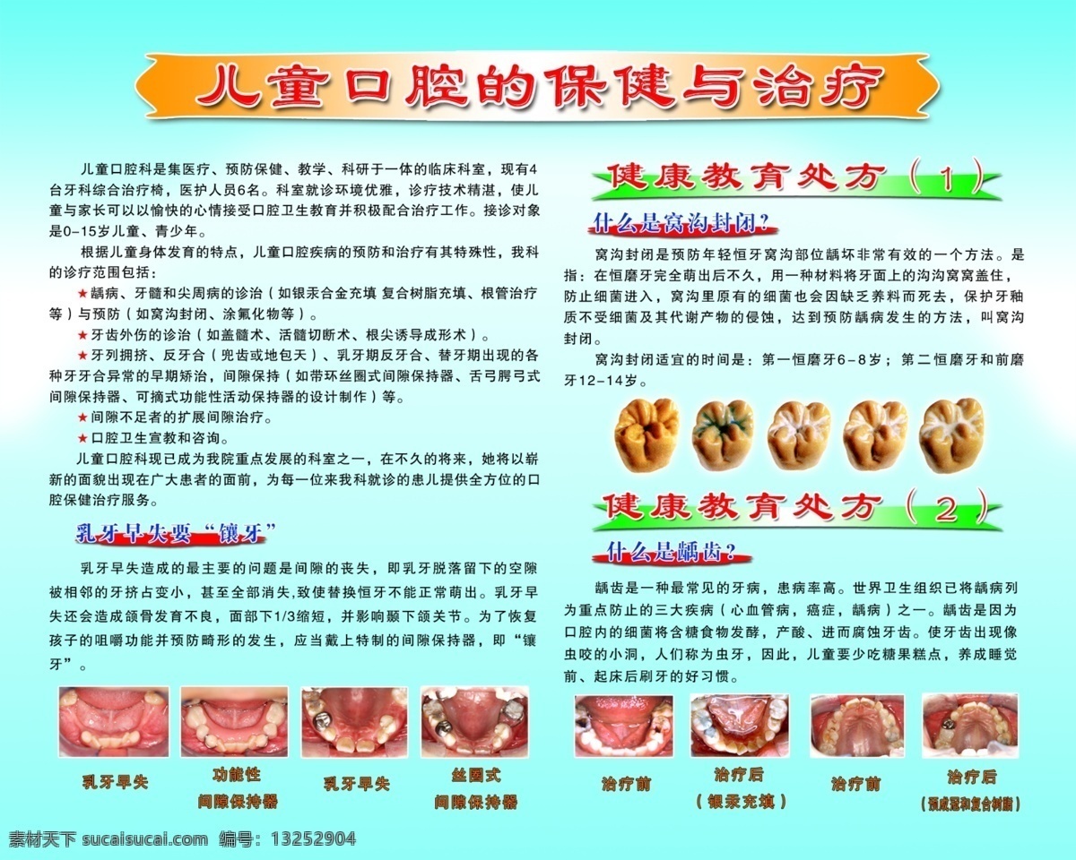 儿童 口腔 保健 治疗 乳牙 早 失 镶牙 什么是窝沟封 什么是龋齿 儿童牙病 分层 源文件