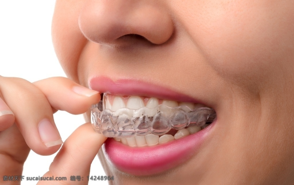 牙箍牙套图片 牙齿 牙箍 牙套 牙线 洁白牙齿 牙齿矫正 口腔护理 牙科 牙模型 文化艺术